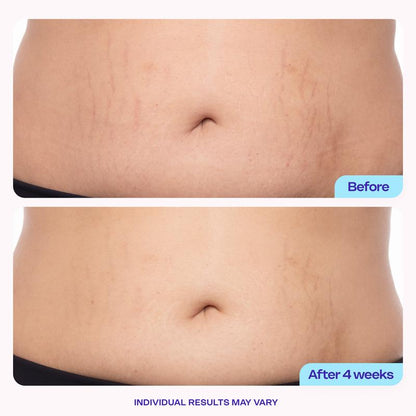 Skin Huge Tighten & Smooth Belly Firming Cream